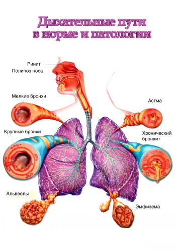 бронхиальная астма хобл